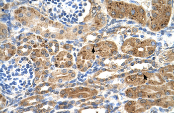 NEDD9 Rabbit Polyclonal Antibody