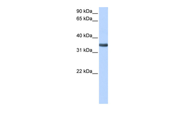 SPON2 Rabbit Polyclonal Antibody