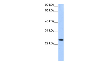 EGLN3 Rabbit Polyclonal Antibody