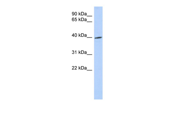 TRIB1 Rabbit Polyclonal Antibody