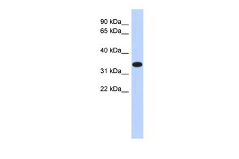 ACTRT1 Rabbit Polyclonal Antibody