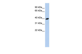 ARL13B Rabbit Polyclonal Antibody
