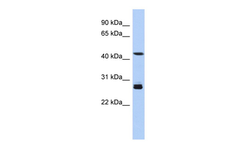 SYT9 Rabbit Polyclonal Antibody