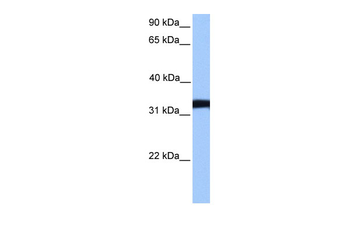 LDHC Rabbit Polyclonal Antibody