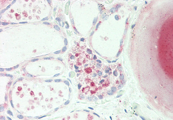 PDE1A Rabbit Polyclonal Antibody