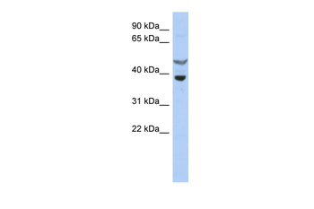 SOCS7 Rabbit Polyclonal Antibody