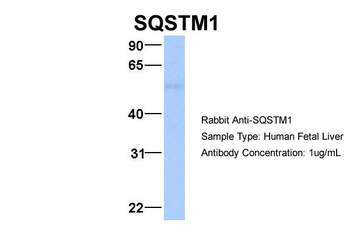 SQSTM1 Rabbit Polyclonal Antibody