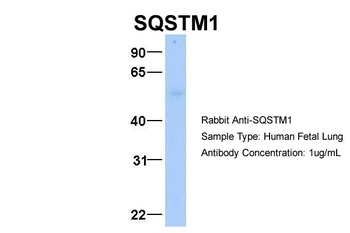 SQSTM1 Rabbit Polyclonal Antibody