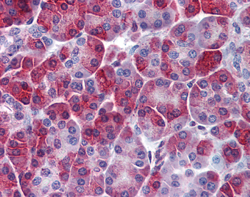 SQSTM1 Rabbit Polyclonal Antibody