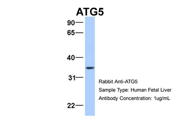 ATG5 Rabbit Polyclonal Antibody
