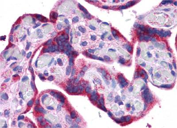 ATG5 Rabbit Polyclonal Antibody