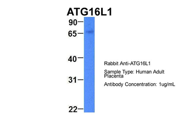 ATG16L1 Rabbit Polyclonal Antibody