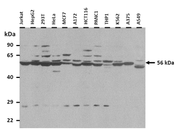 IMPDH2 Rabbit Polyclonal Antibody
