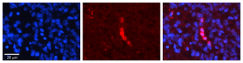 ACADVL Rabbit Polyclonal Antibody