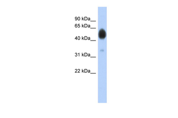 ARSA Rabbit Polyclonal Antibody