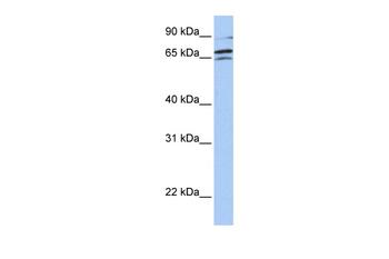 ARAF Rabbit Polyclonal Antibody