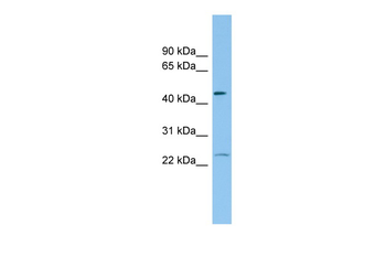 FTH1 Rabbit Polyclonal Antibody