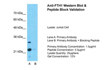 FTH1 Rabbit Polyclonal Antibody