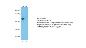 GRN Rabbit Polyclonal Antibody