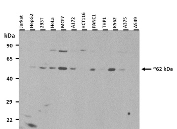 GRN Rabbit Polyclonal Antibody