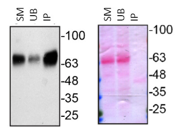 GRN Rabbit Polyclonal Antibody