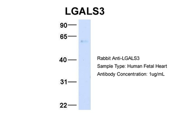 LGALS3 Rabbit Polyclonal Antibody