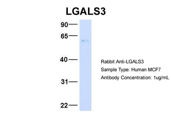 LGALS3 Rabbit Polyclonal Antibody