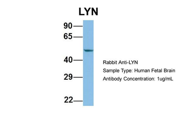 LYN Rabbit Polyclonal Antibody