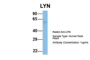 LYN Rabbit Polyclonal Antibody