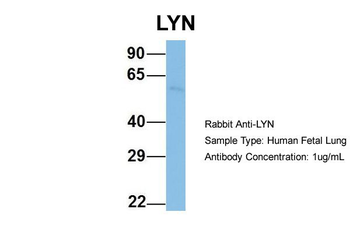 LYN Rabbit Polyclonal Antibody