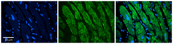 EPS8 Rabbit Polyclonal Antibody