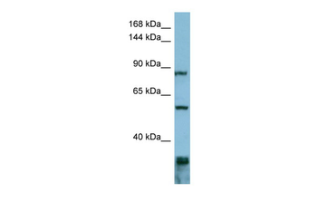 EPS8 Rabbit Polyclonal Antibody