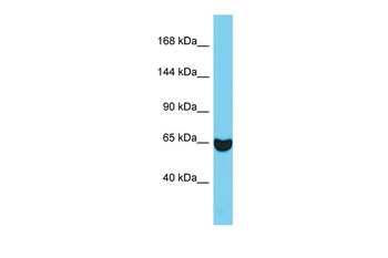EPS8 Rabbit Polyclonal Antibody