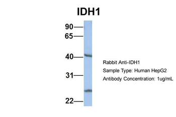 IDH1 Rabbit Polyclonal Antibody