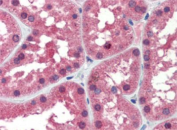 IDH1 Rabbit Polyclonal Antibody
