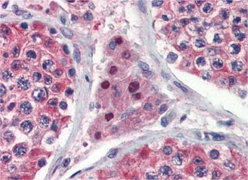 IDH1 Rabbit Polyclonal Antibody