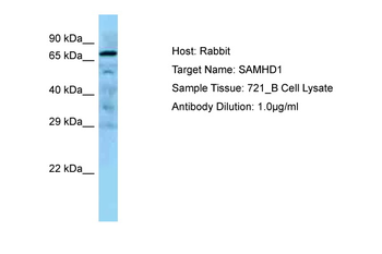SAMHD1 Rabbit Polyclonal Antibody