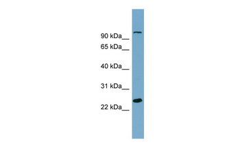 SEMA3D Rabbit Polyclonal Antibody