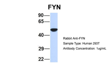 FYN Rabbit Polyclonal Antibody