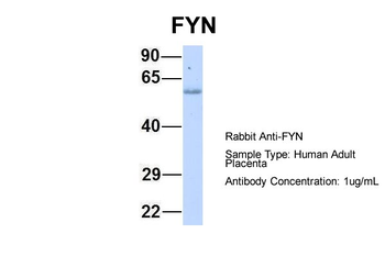 FYN Rabbit Polyclonal Antibody