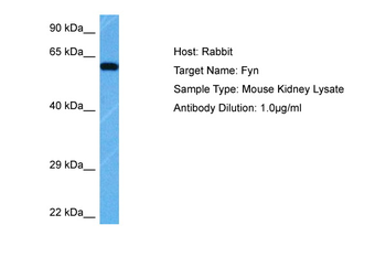 FYN Rabbit Polyclonal Antibody
