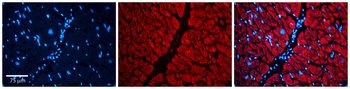PAFAH1B1 Rabbit Polyclonal Antibody