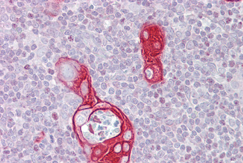 FAIM Rabbit Polyclonal Antibody
