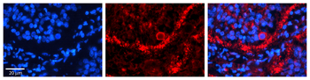 ACO2 Rabbit Polyclonal Antibody