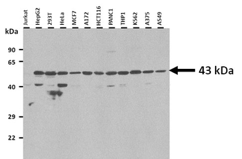 FANCL Rabbit Polyclonal Antibody