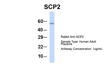 SCP2 Rabbit Polyclonal Antibody