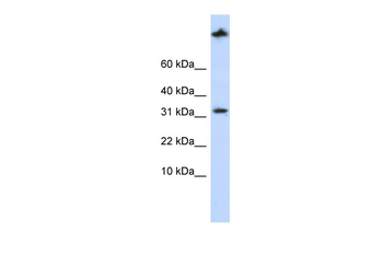SCP2 Rabbit Polyclonal Antibody