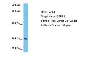 SFRP2 Rabbit Polyclonal Antibody