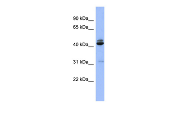 SH3GL1 Rabbit Polyclonal Antibody