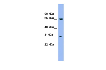 NDUFS3 Rabbit Polyclonal Antibody